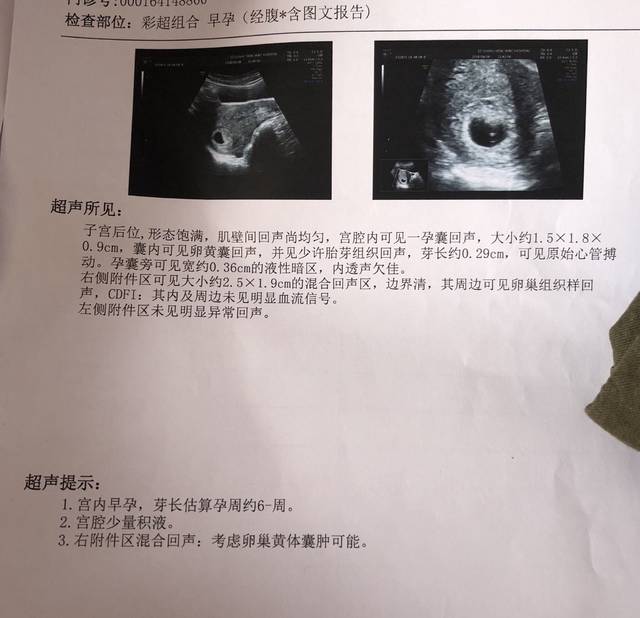哈尔滨十大供卵试管婴儿医院有哪些？哪些医院做供卵试管婴儿