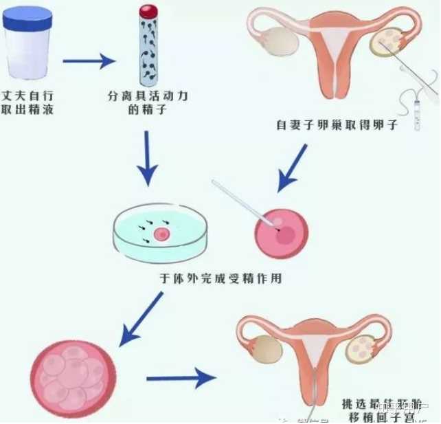 有妇科炎症可以去美国做供卵三代代生试管吗？