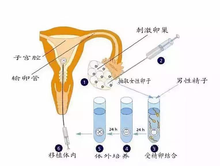做借卵三代代生试管移植后会对高HCG有反应吗？不一定!数值越高越好!