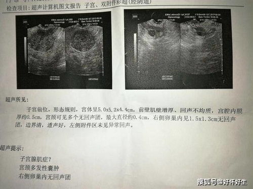 供卵试管婴儿胚胎移植后多久能测出来