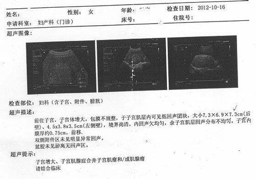供卵试管人工周期和自然周期的区别是什么