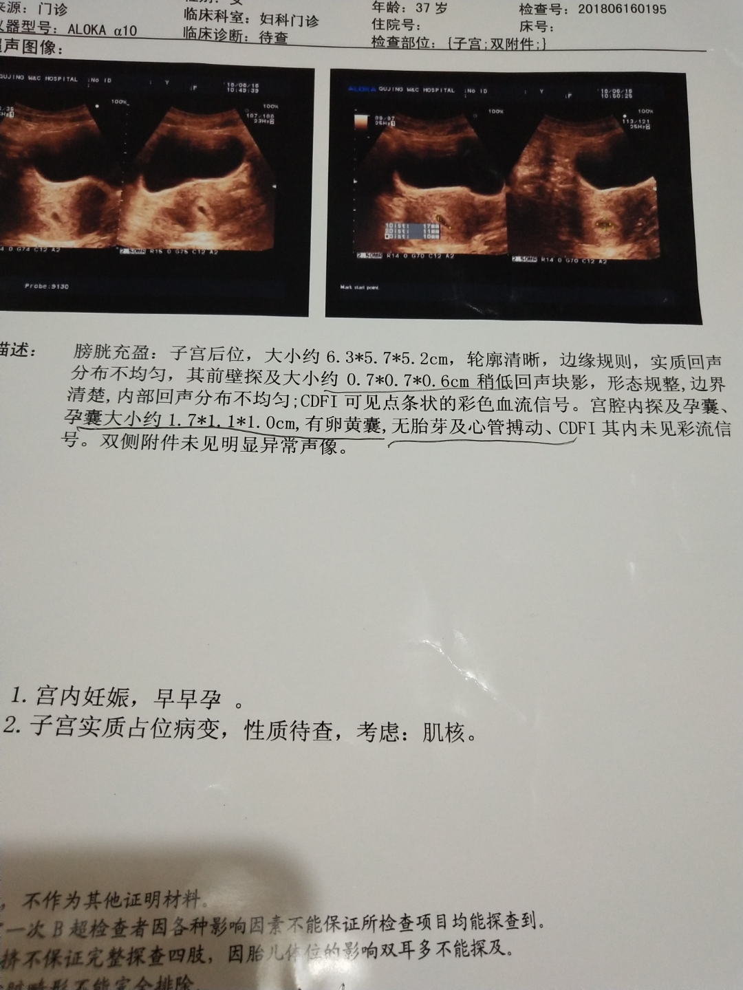 哈尔滨哈尔滨中信湘雅赠卵试管医院附近的你有哪些旅游景点