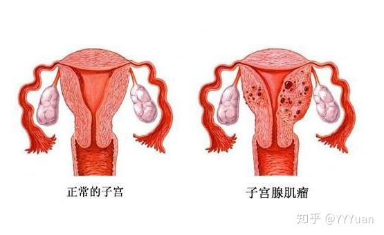 女方正常男方弱精试管成功率