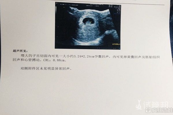 试管婴儿什么意思
