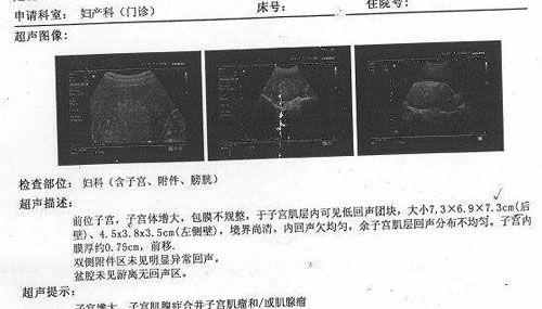 试管婴儿什么意思