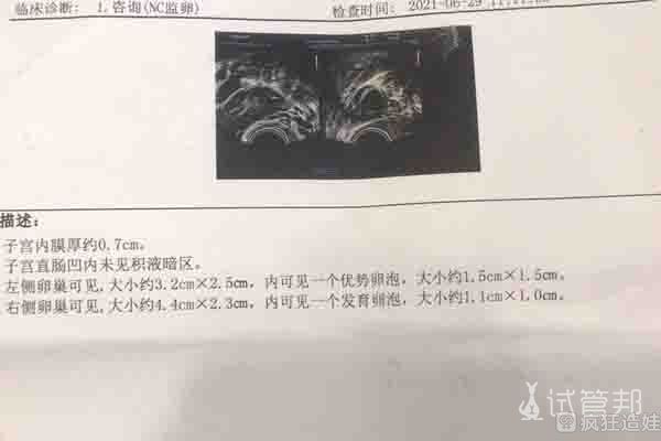 大龄女性做哈尔滨试管需要注意什么