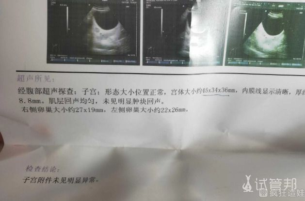 人工授精导管使用方法(人工授精导管)