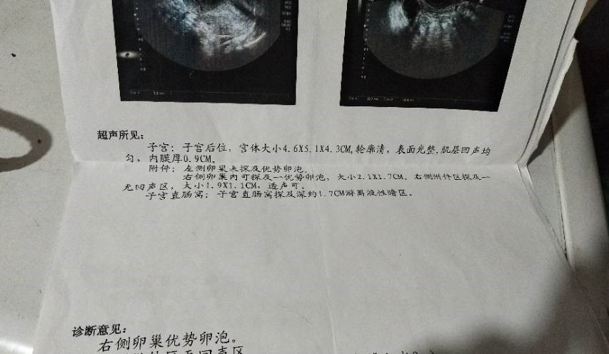 生子代生试管赛增怎么打打在什么部位比较合适