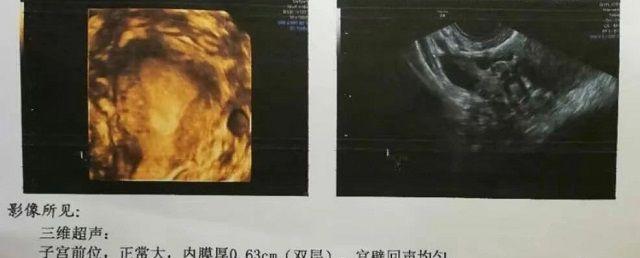41岁我想找人代怀生子的成功率是多少(高龄试管代怀去哪个机构能成功吗)