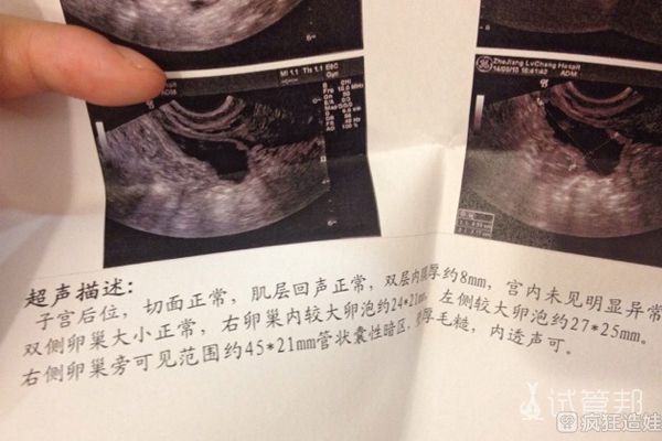 41岁我想找人代怀生子的成功率是多少(高龄试管代怀去哪个机构能成功吗)
