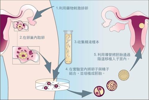 哈尔滨试管代怀技术孕妇能吃什么代生孩子哪家便宜移植后吃什么容易着床呢