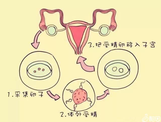 正规生殖医院借卵商业化试管代怀生子大概多少钱