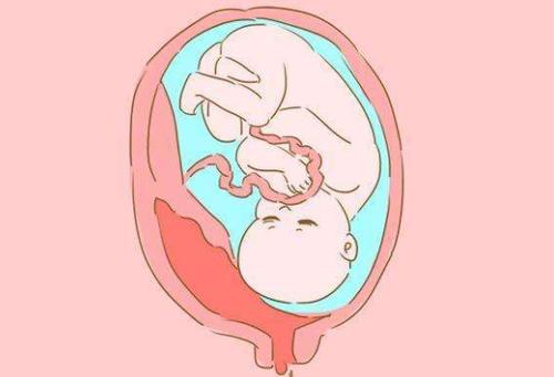 女方13号染色体平衡易位助孕代生产医院排名的成功率有多少