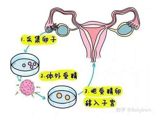 哈尔滨试管代生助孕机构性别选择女性不孕不育的症状