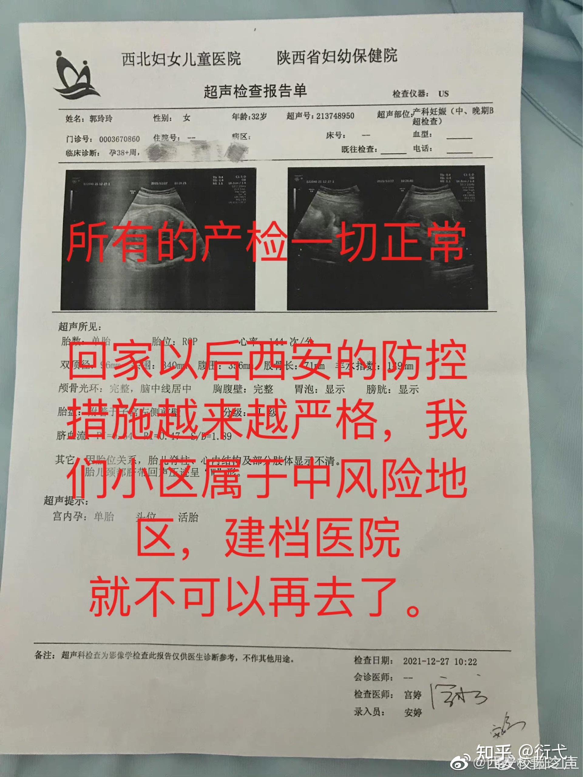 试管微刺激方案能移植鲜胚吗